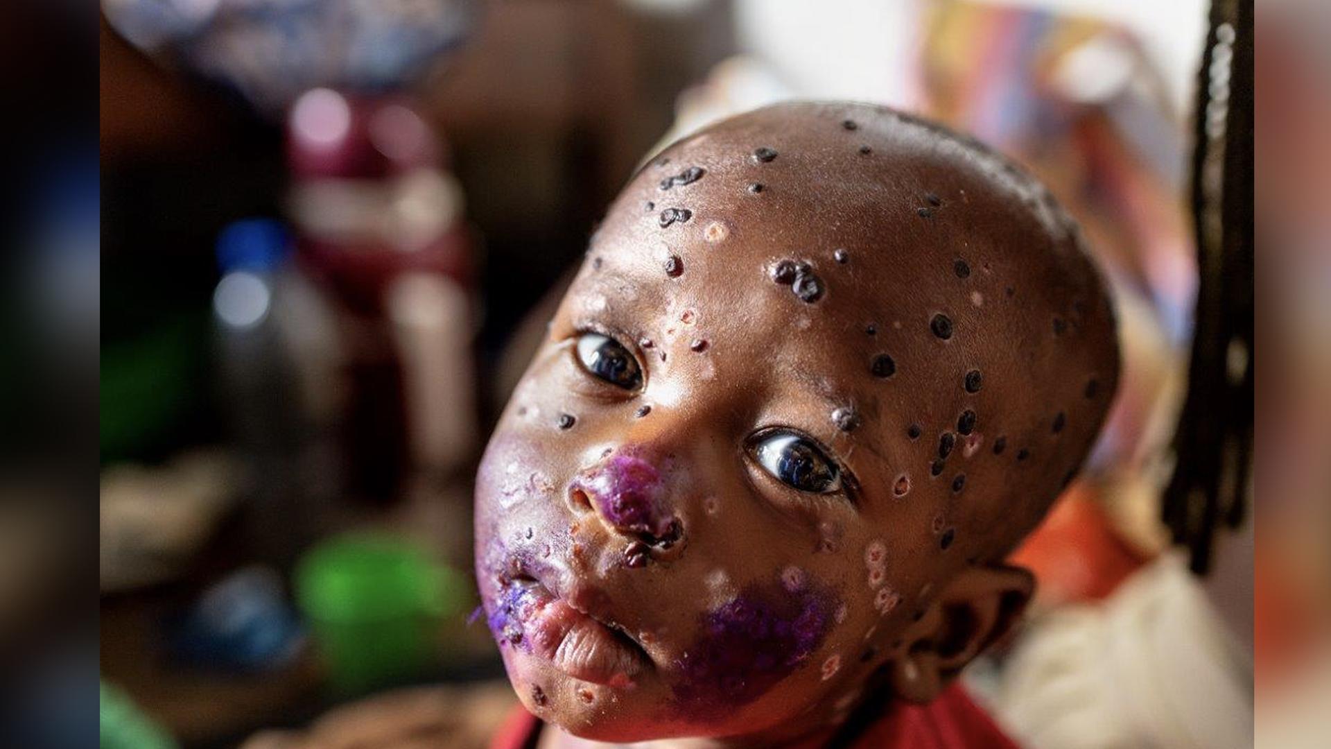 Zweiter Preis UNICEF Foto des Jahres 2024