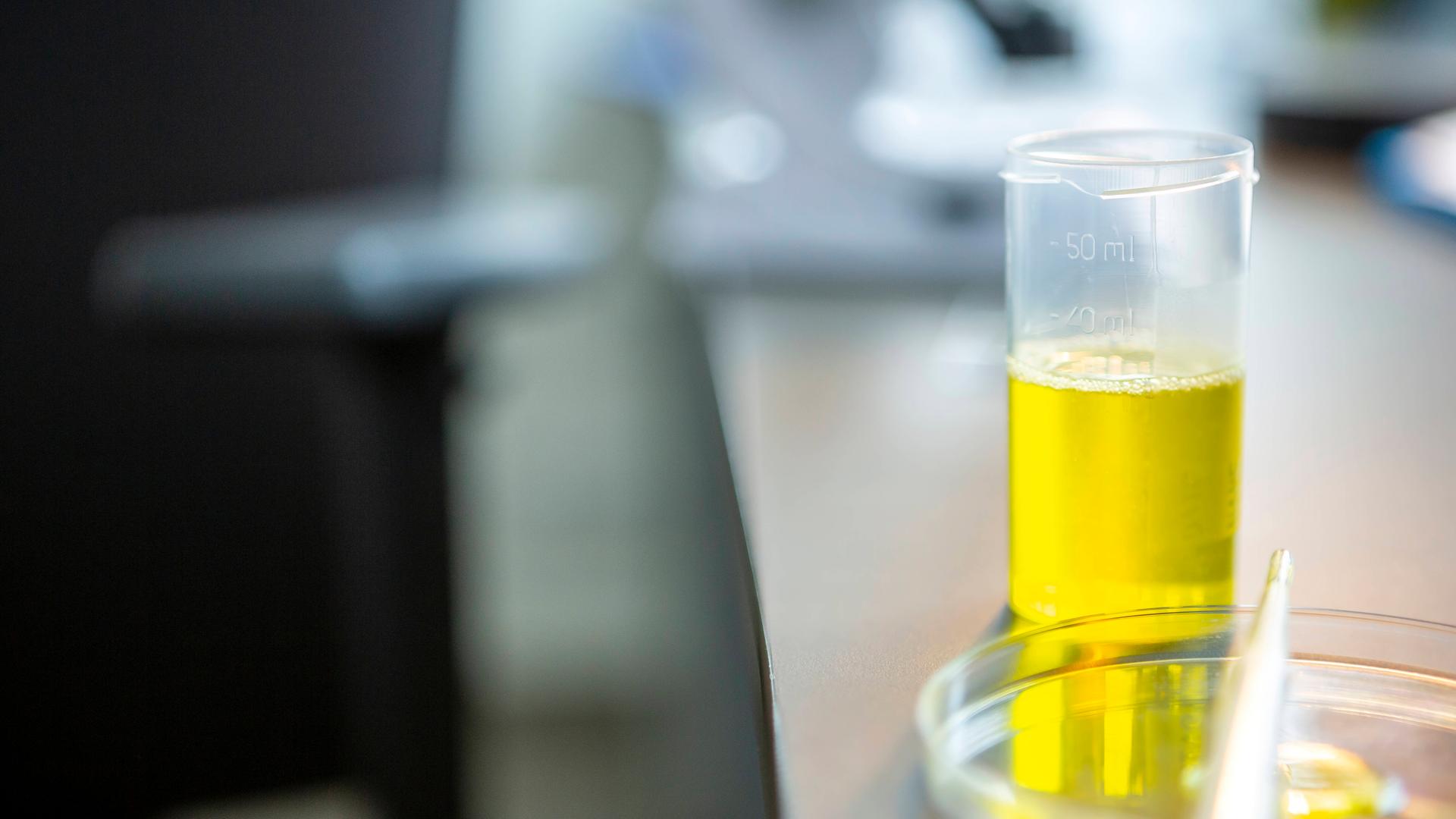 Fläschchen mit Urinprobe im Labor