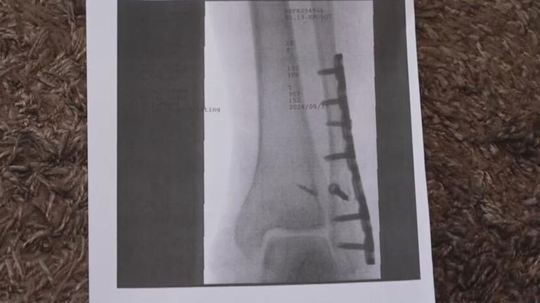 Versicherung verweigert Schadenersatz