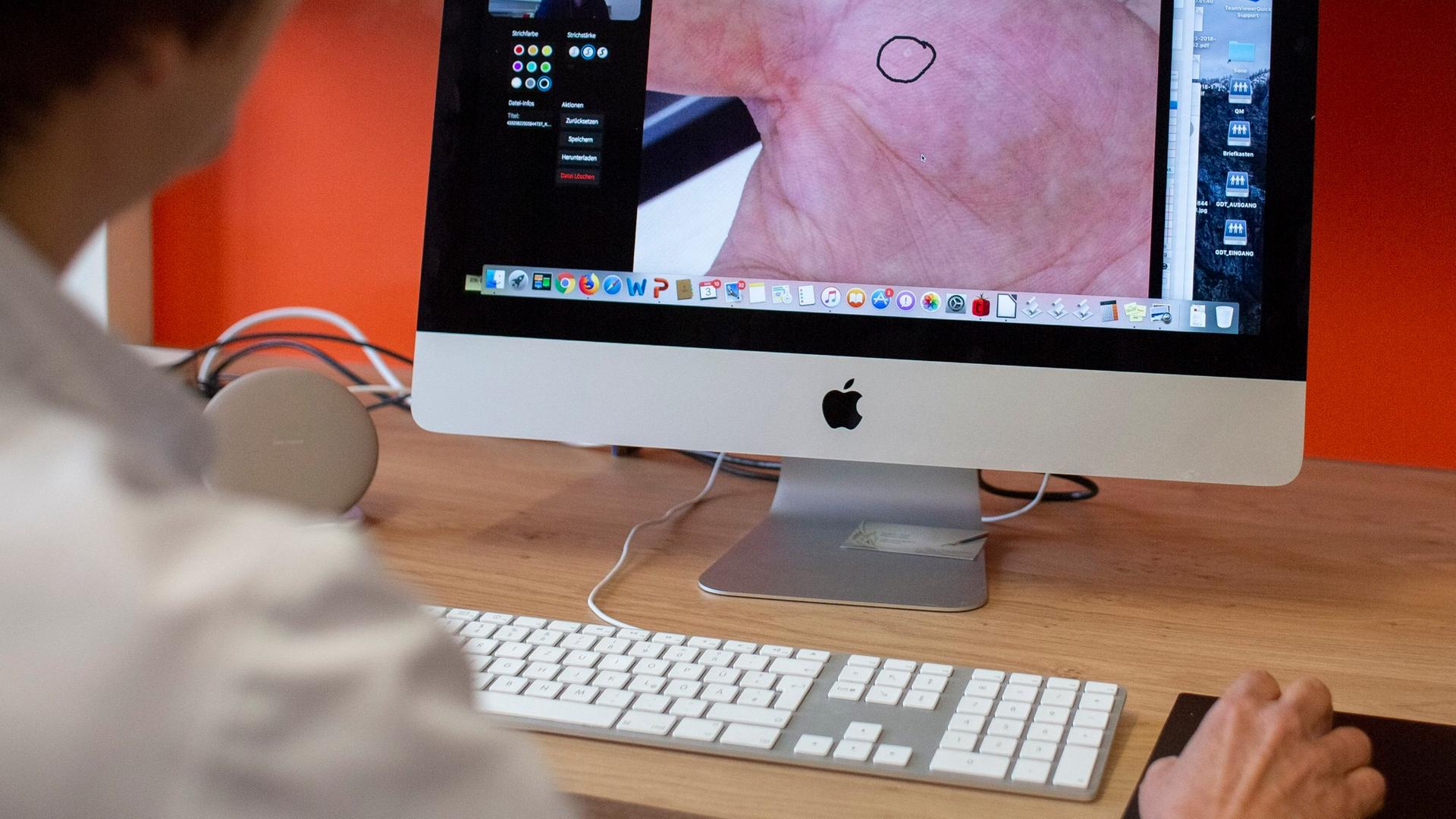 Eine Fachärztin für Dermatologie und Venerologie zeigt, wie die Behandlung von Hautpatienten per Video funktioniert. 