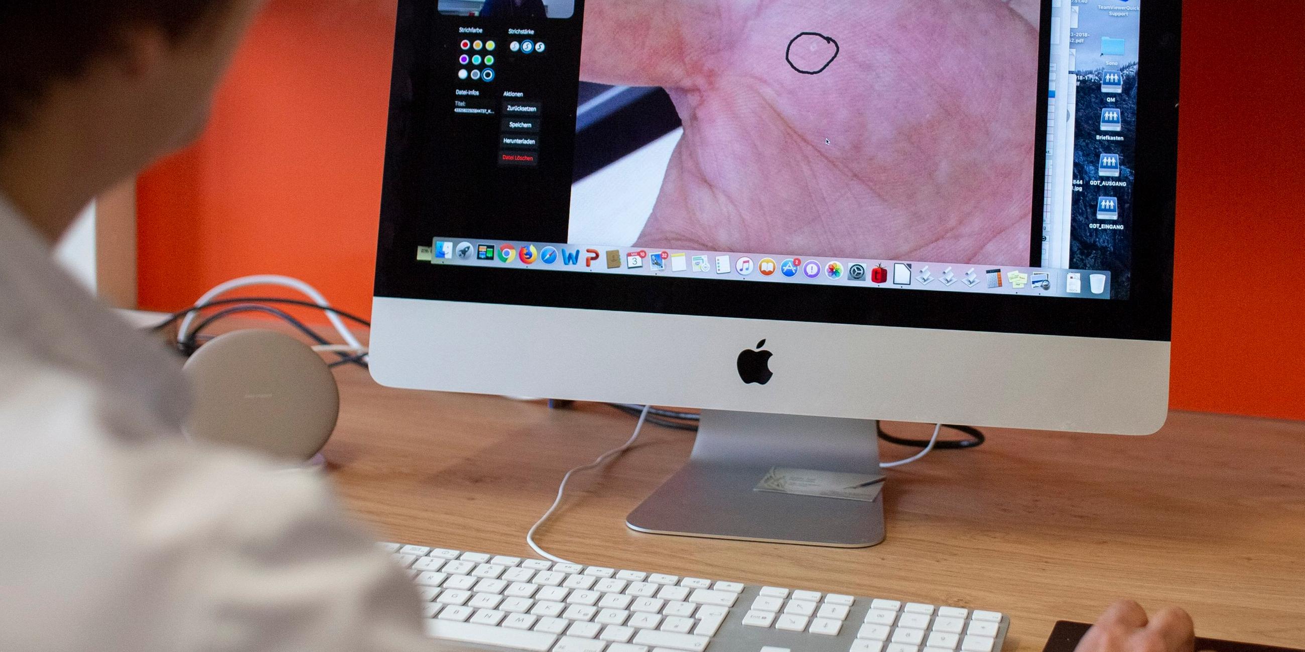 Eine Fachärztin für Dermatologie und Venerologie zeigt, wie die Behandlung von Hautpatienten per Video funktioniert. 