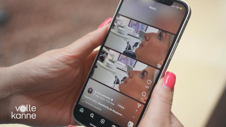 Handy in der Hand mit Vor- und Nachherfotos von Nasen-OP