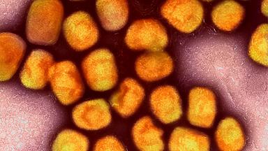 Eine kolorierte transmissionselektronenmikroskopische Aufnahme von Partikeln des Affenpockenvirus (Gold), kultiviert und gereinigt aus einer Zellkultur, aufgenommen in der NIAID Integrated Research Facility, veröffentlicht am 26. Juli 2022, in Fort Detrick, Maryland.