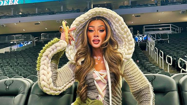Winnie Harlow