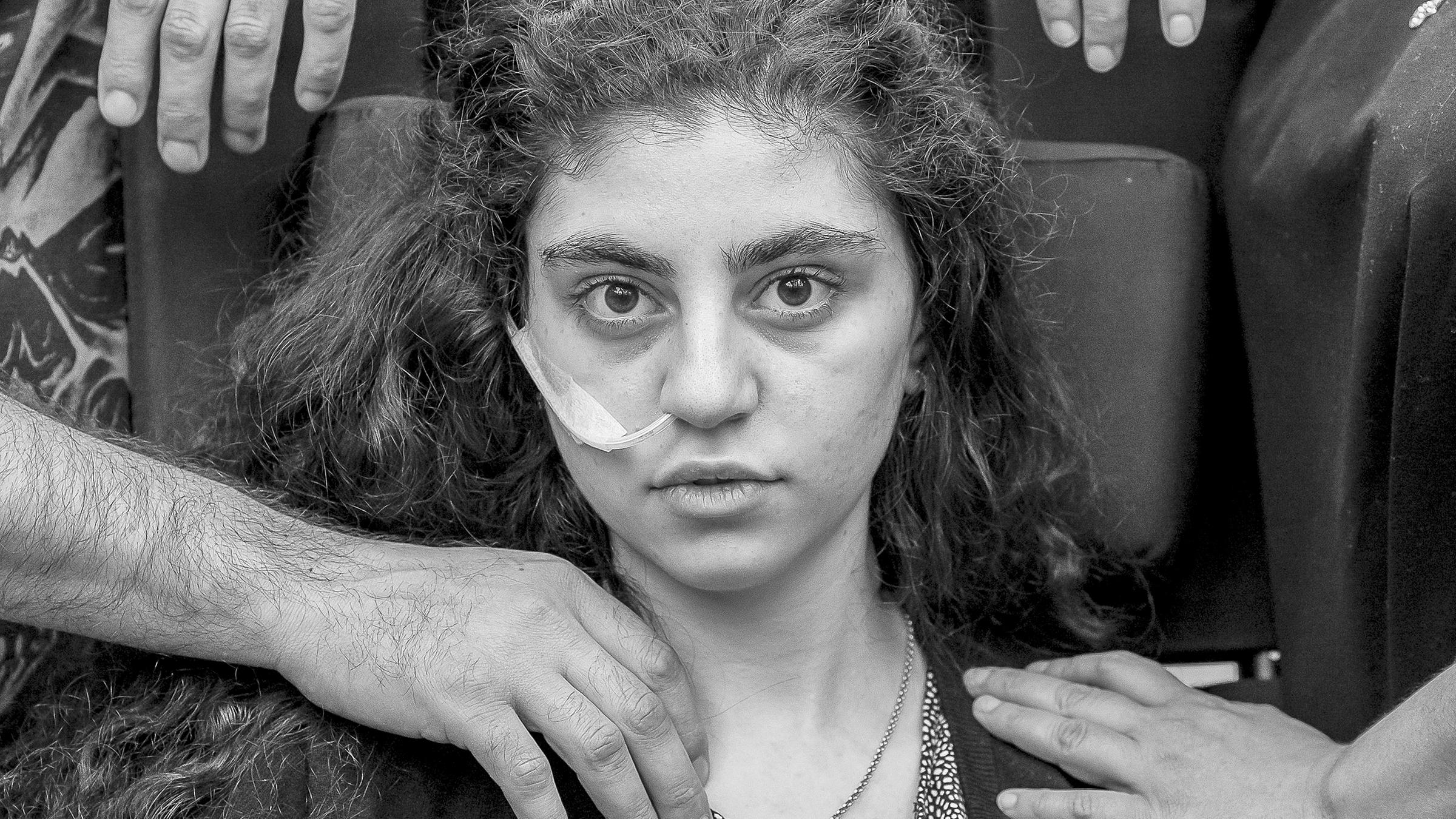 Polen, Podkowa Lesna: Ewa, ein 15-jähriges armenisches Mädchen, das kürzlich aus einem durch das Resignationssyndrom verursachten katatonischen Zustand erwacht ist, sitzt in einem Flüchtlingsaufnahmezentrum in einem Rollstuhl.