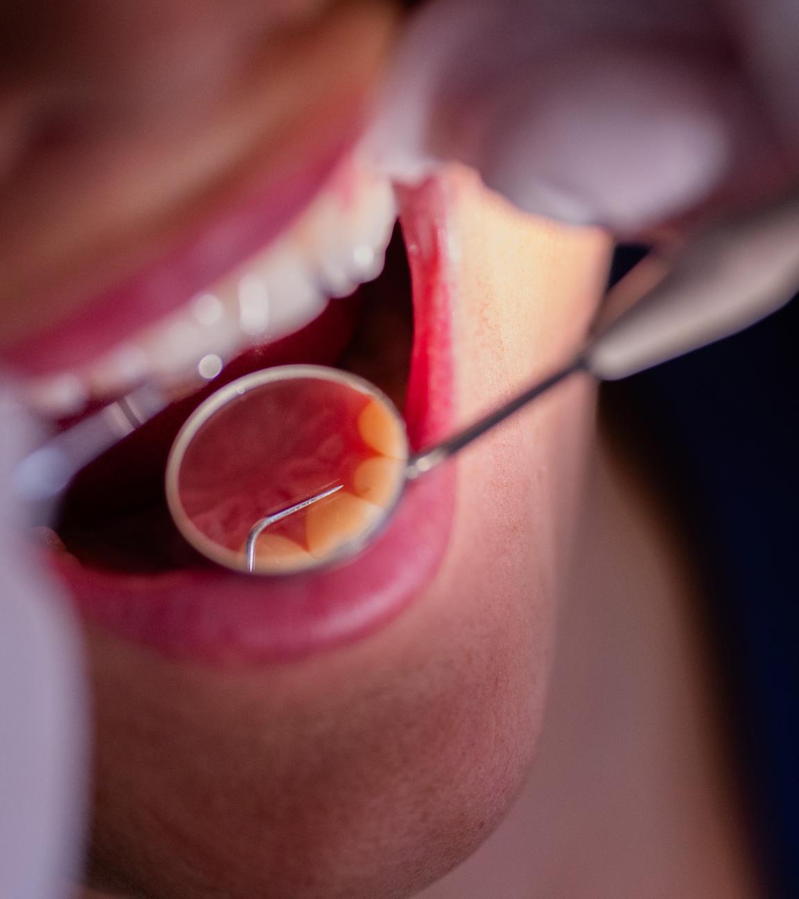 Nordrhein-Westfalen, Mönchengladbach: Ein Zahnarzt schaut sich mit einem Spiegel die Zähne einer Patientin an.