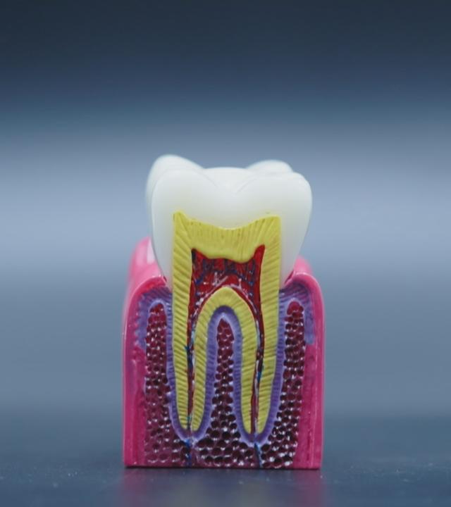 Abbildung eines durchgeschnittenen Zahnes