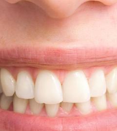 Zähne einer jungen Frau