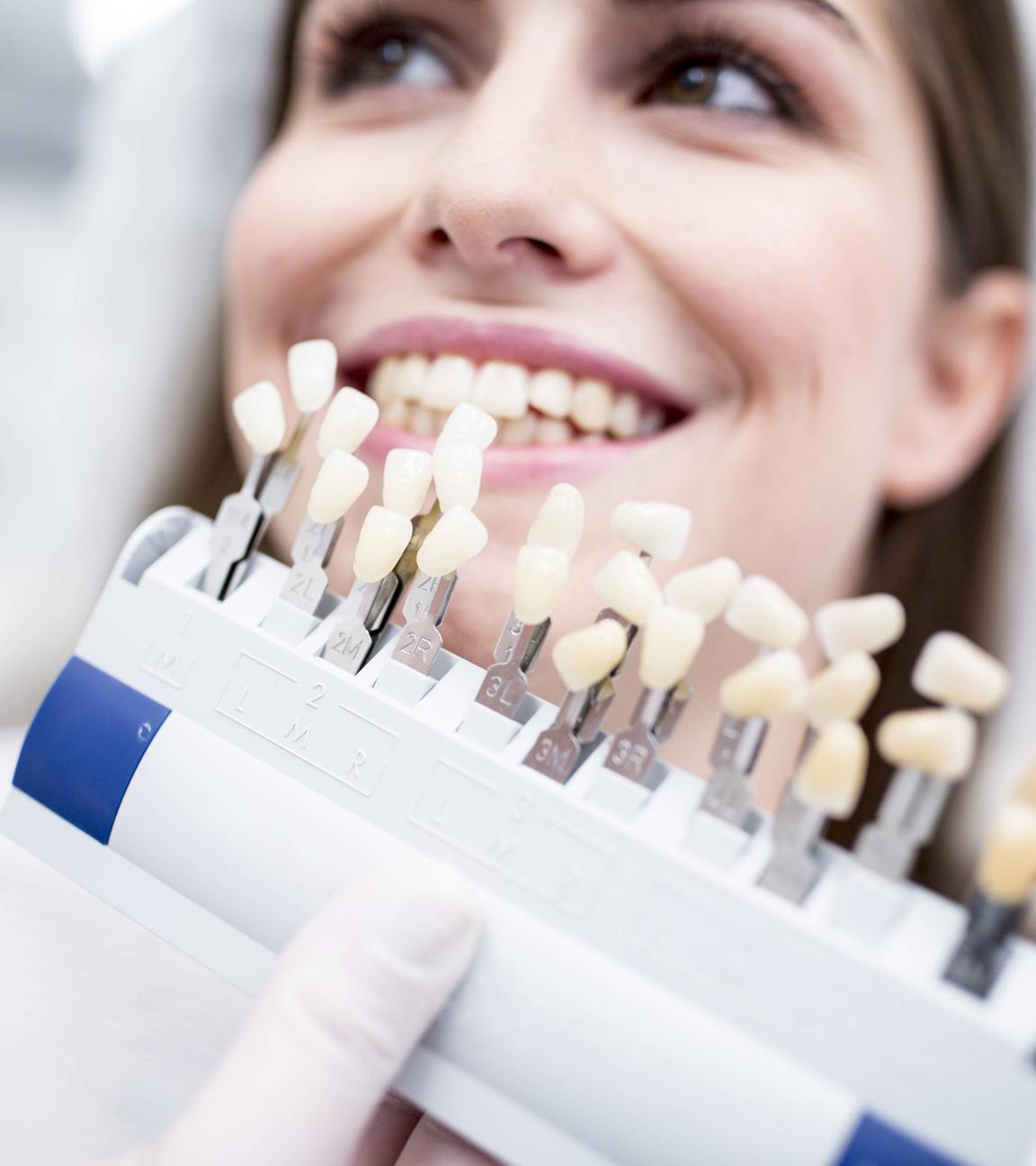 Zahnveneers