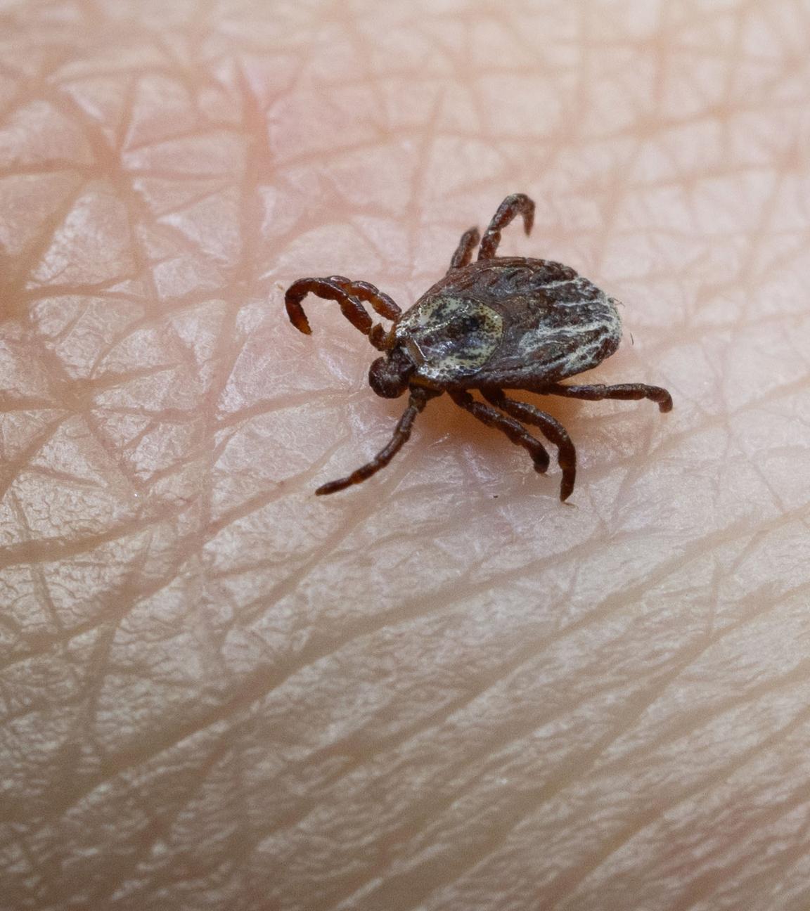 Baden-Württemberg, Stuttgart: Unerwünschte Begegnung: Wer viel draußen unterwegs ist, kann den Kontakt mit Zecken nicht immer vermeiden.